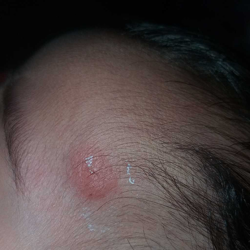 Baby anus swollen red Sperm spunk facial gloryhole xrated