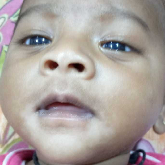 White Patches In Baby Mouth atelieryuwa.ciao.jp