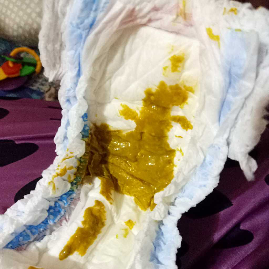 Why My Baby Poop Is Black at Constance Handy blog