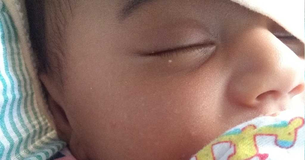 white spots cream face