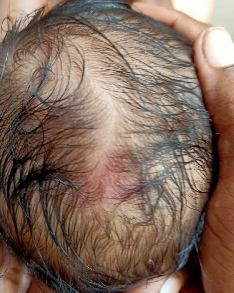 today I notice some type of swelling in head please see the image and