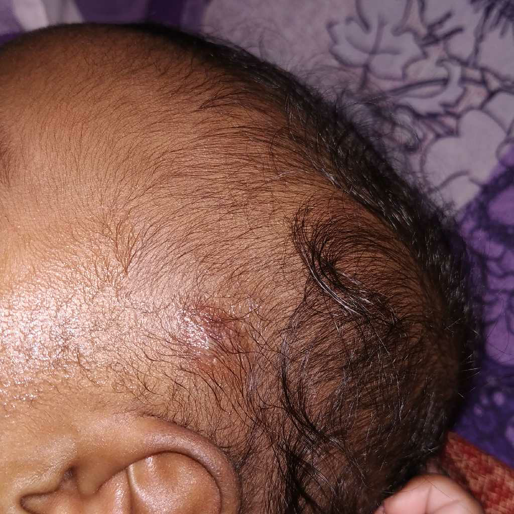 child skin doctor near me