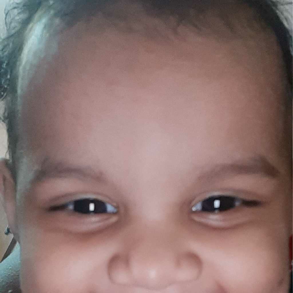 AskTheExpert my baby is 5 months old . He has slight swelling and a