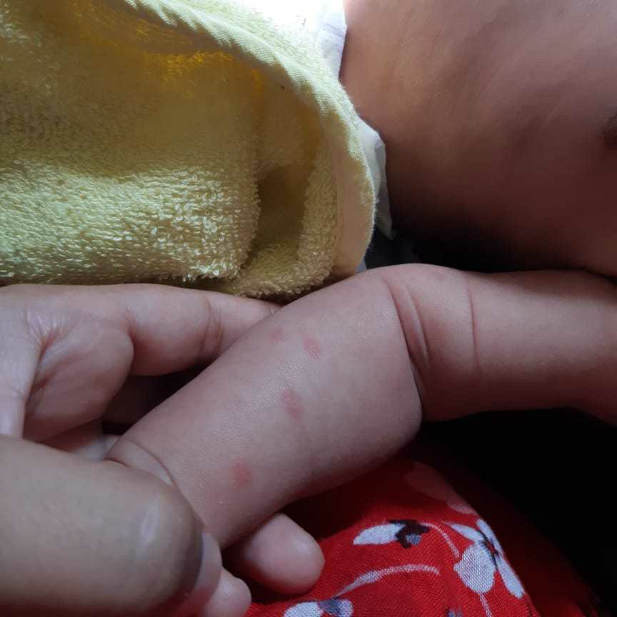 My Baby Is 40 Days Old I Can See Some Red Spots On Her Skin Which