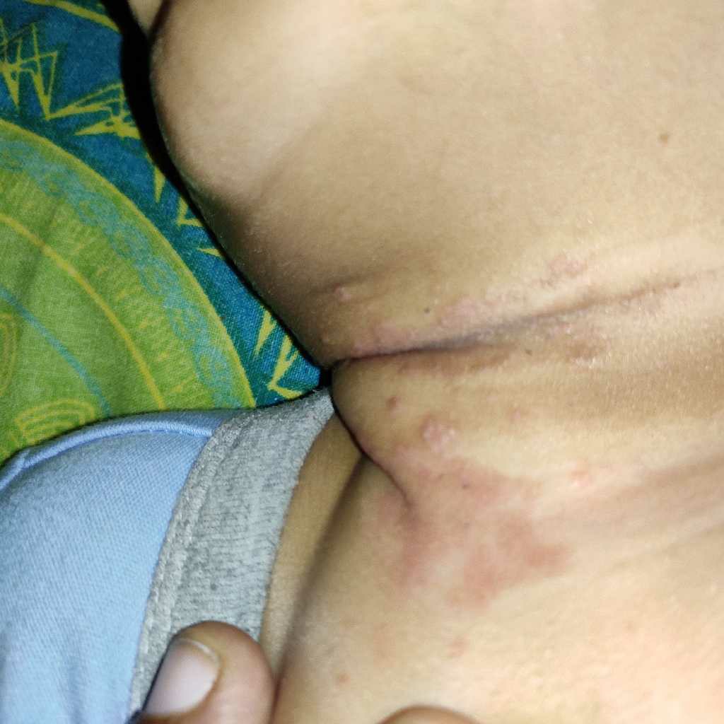 candid cream for baby rash