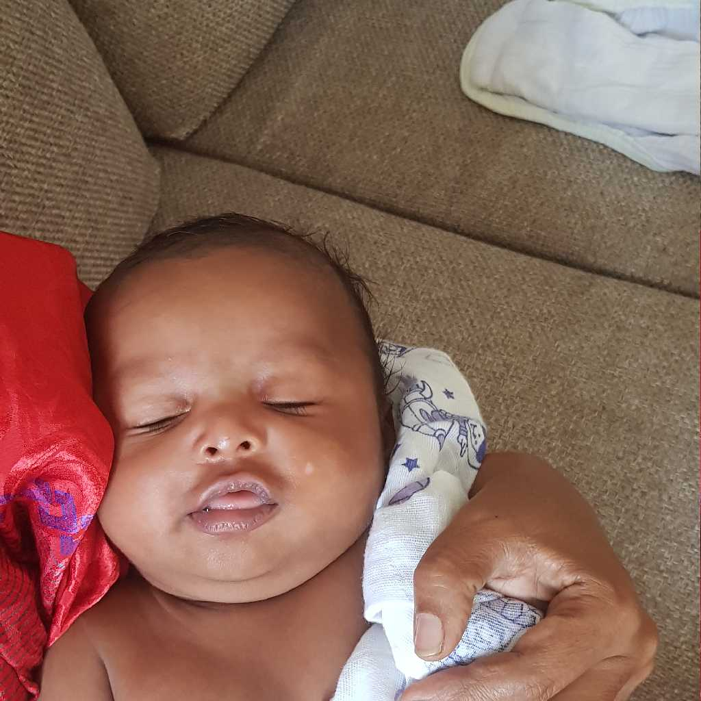 my baby got hurt on her face.. it was a scratch with mild bleeding