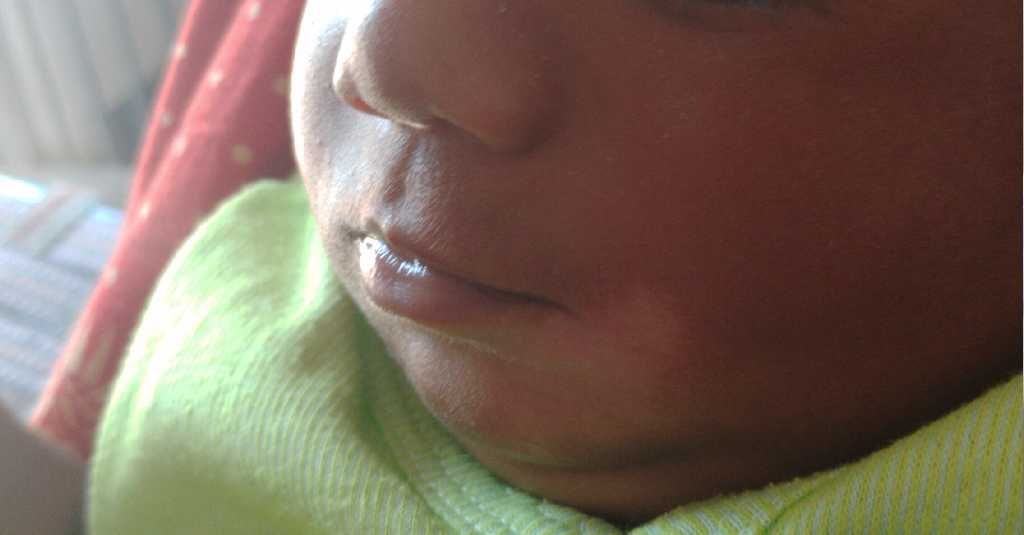 my baby is 19 months old . she has some white around her mouth alone