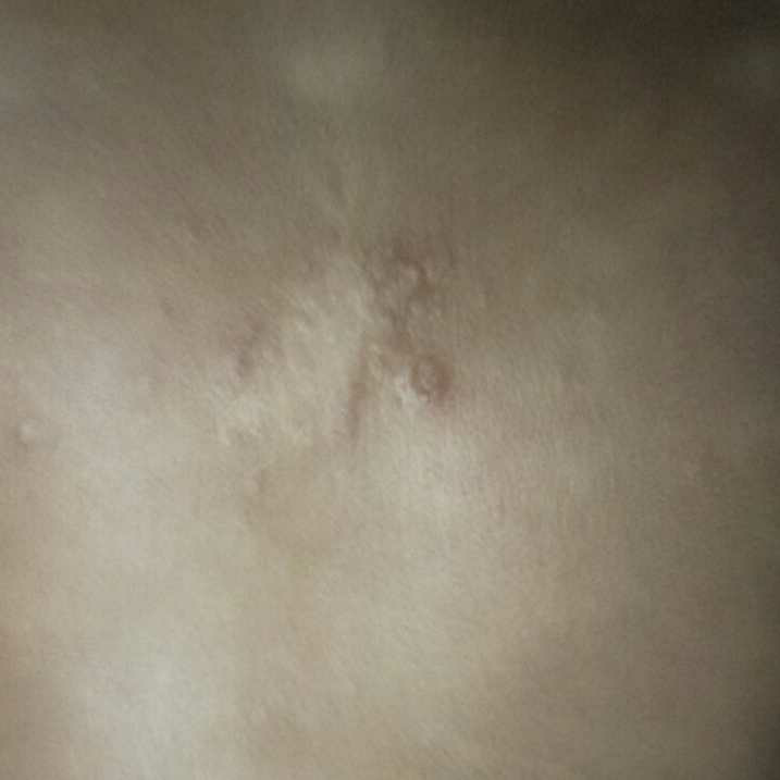 I have observed blood in my baby diaper It’s from the vaginal part only