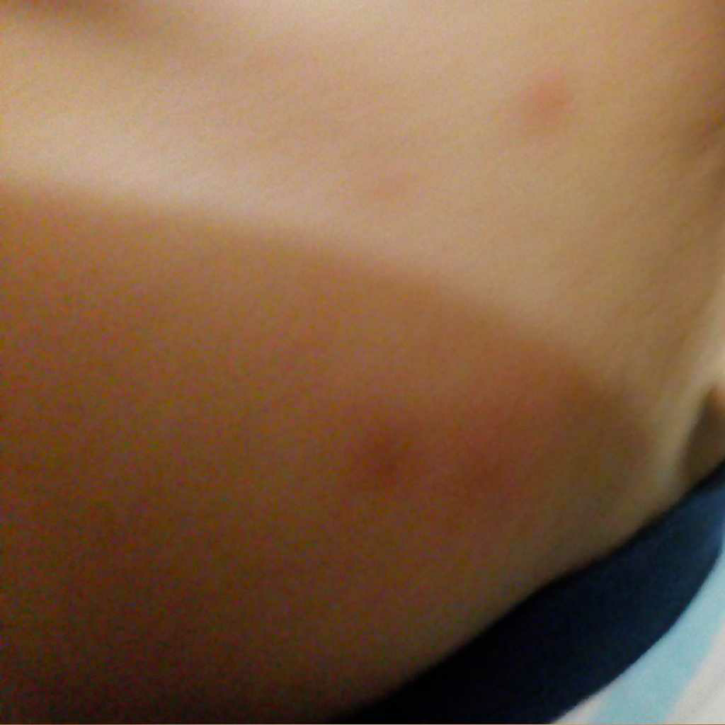 odomos for 6 months baby