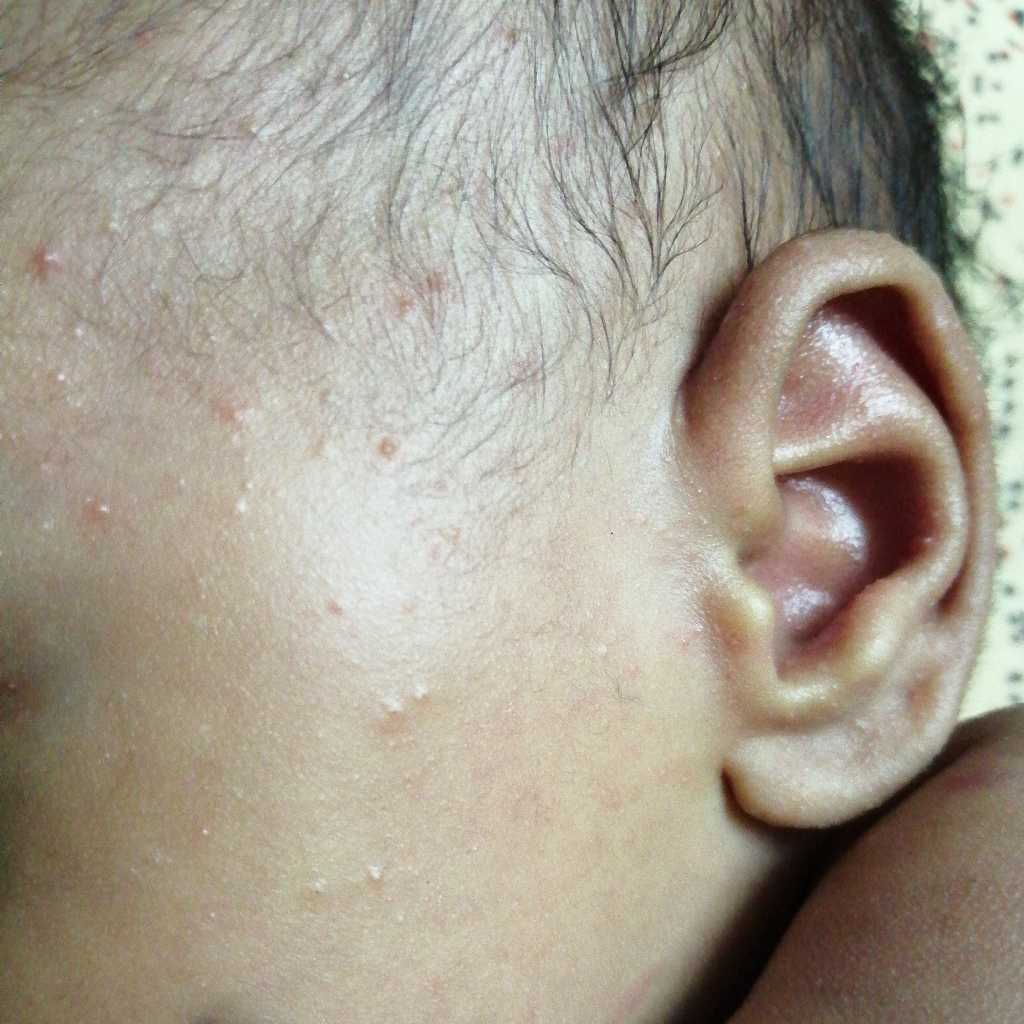 paediatrician Hi Dr, My younger one is 26days old boy and could see