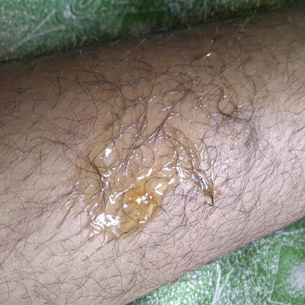 Black jelly type in baby stool.. what is that?? FirstCry Parenting