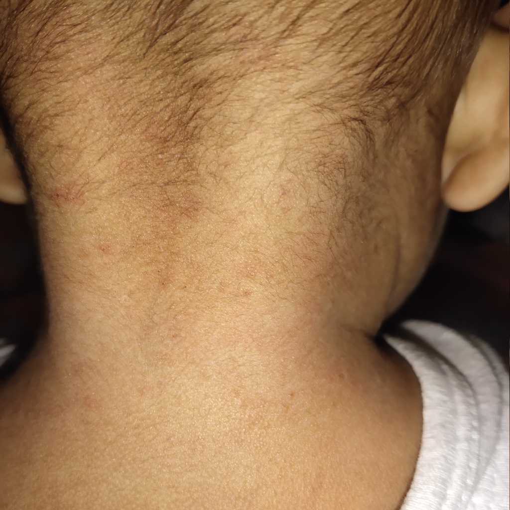 nycil powder for baby boy