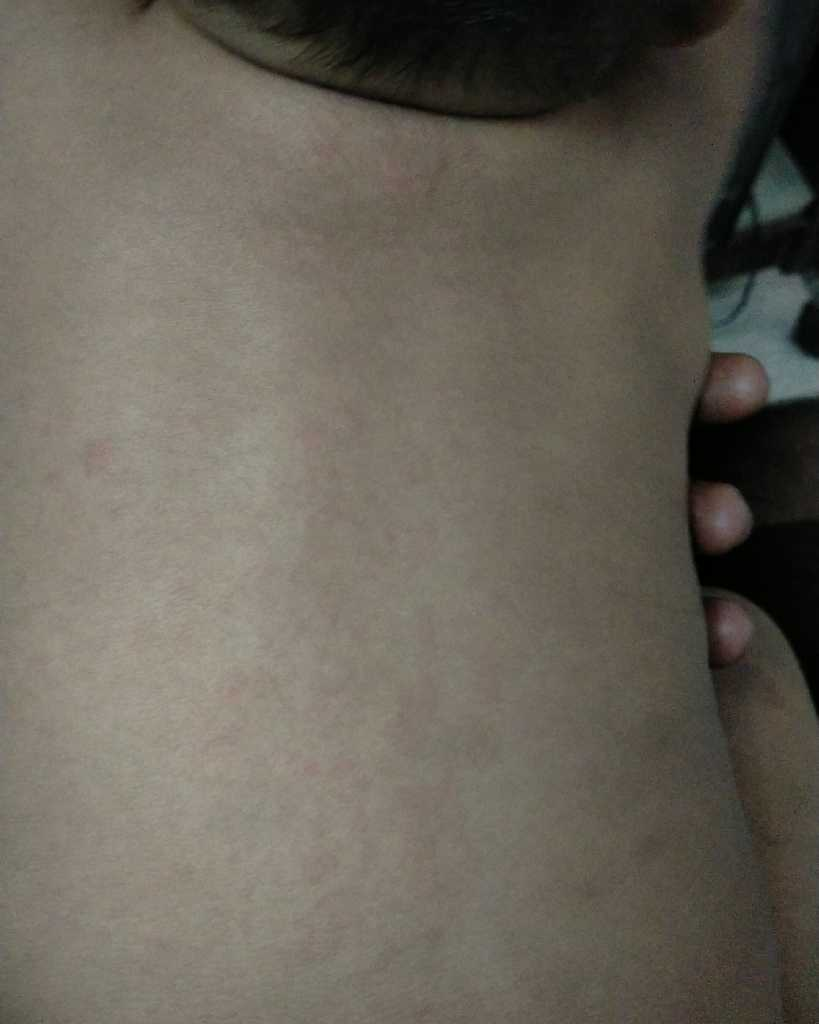 My baby has red spots on her body... day by day it's increasing... I