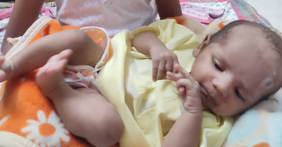 mycoderm powder use for baby