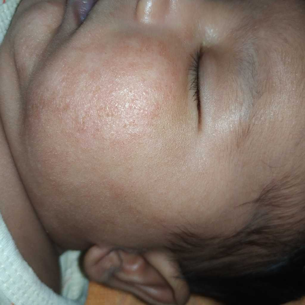 dermadew baby moisturizer