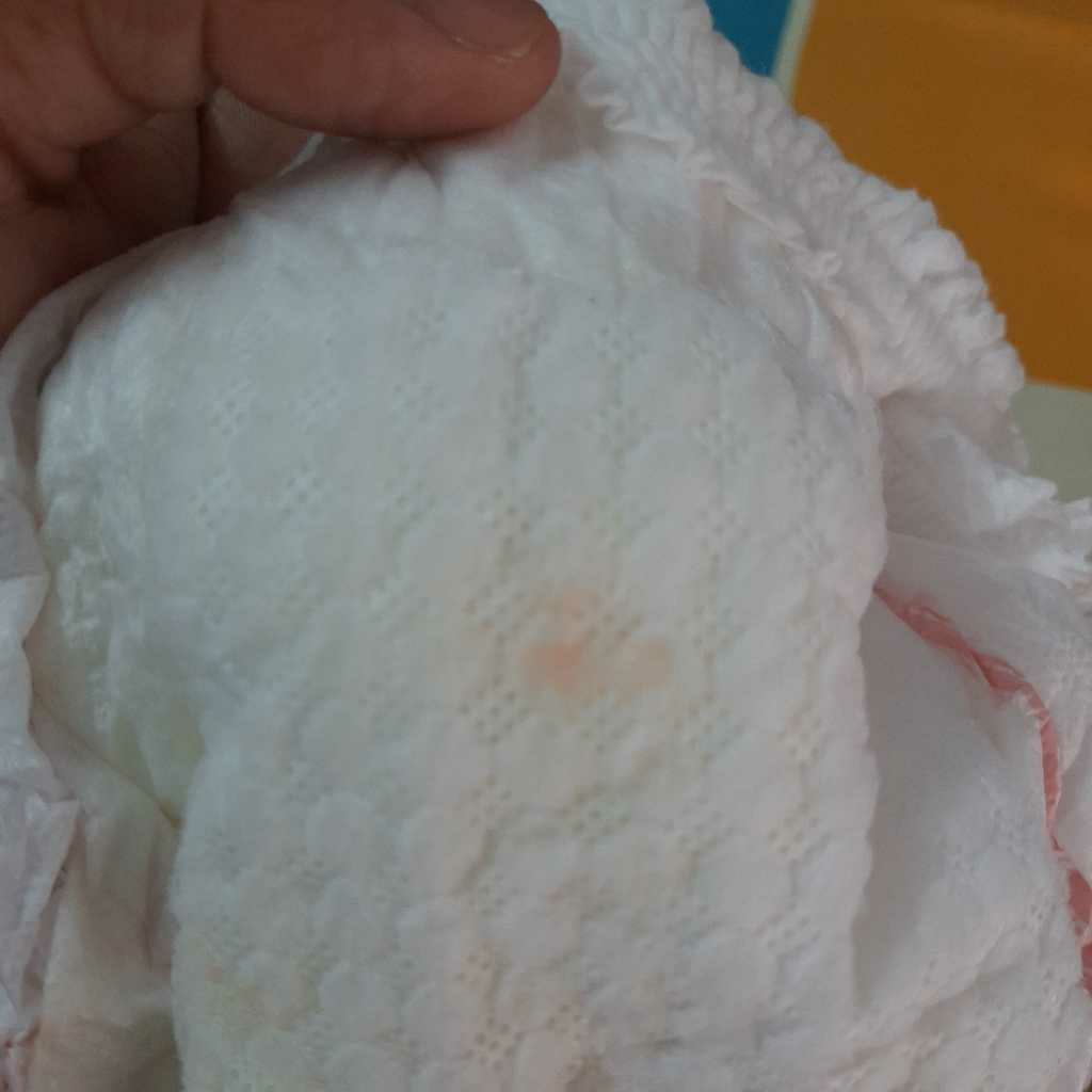 Hello my baby girl is 2 months old and i found some blood spots in her