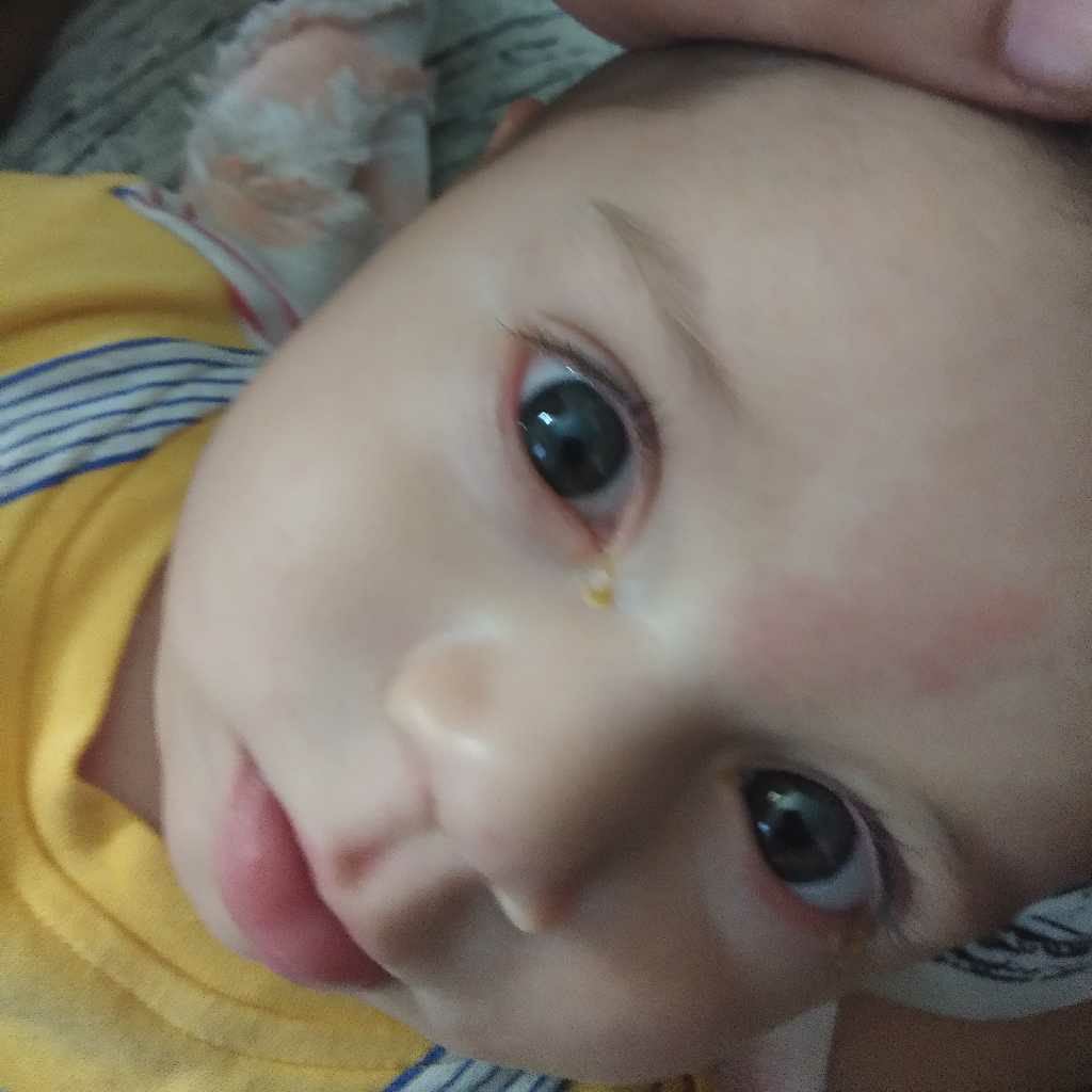 Hi My baby s 3 months old. She woke up today morning with eyes closed