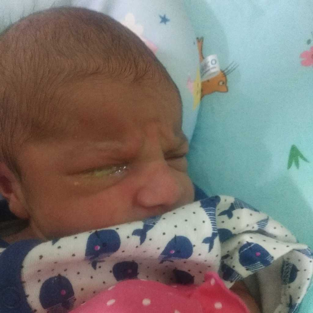 AskTheExpert My baby is 3 months old. She hurt herself near her left