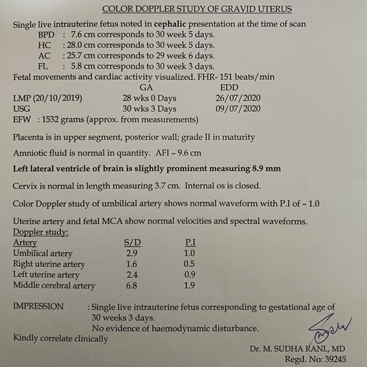 Breech babies are smarter image