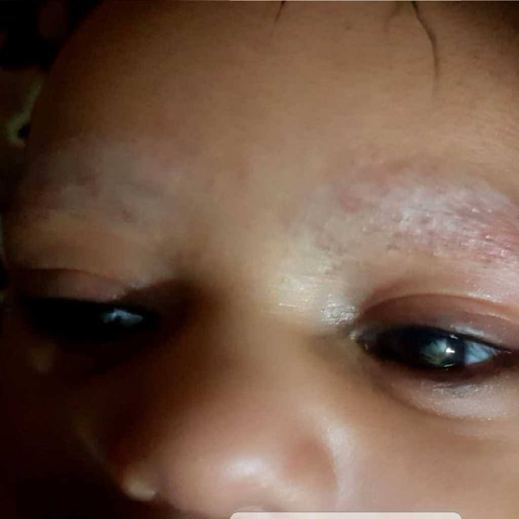 my 5 week baby boy is having some redish rashes behind ears also