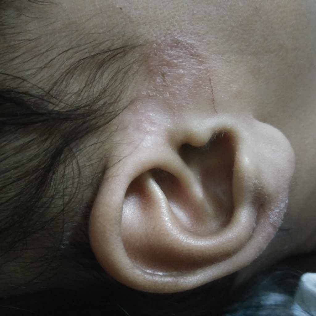 child skin doctor near me