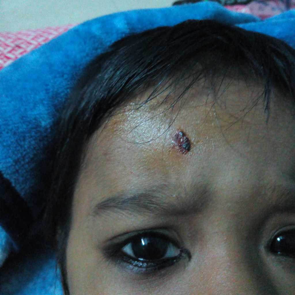 abzorb powder for babies