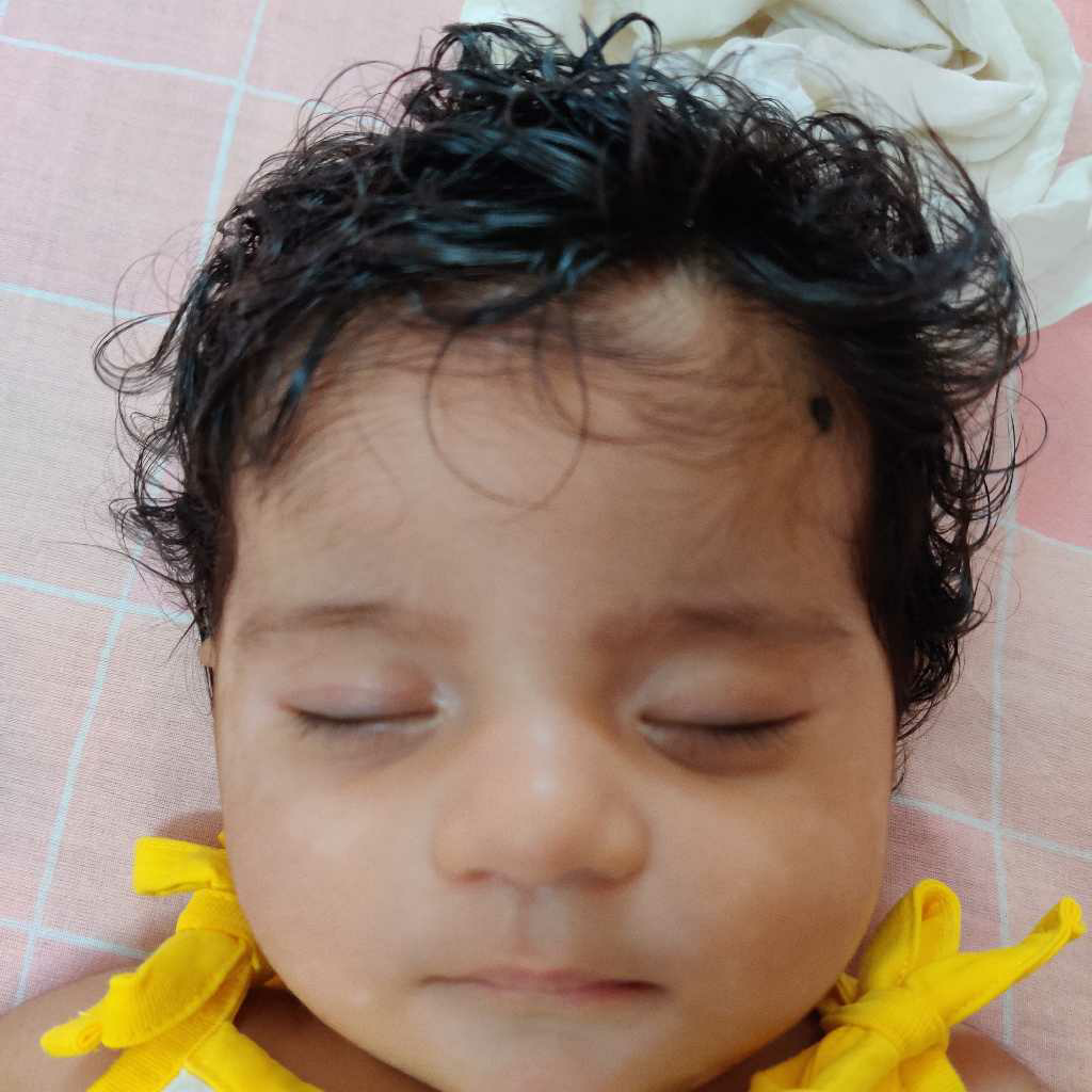 Hi my baby biy is 1.5 months old and he has white patches under the