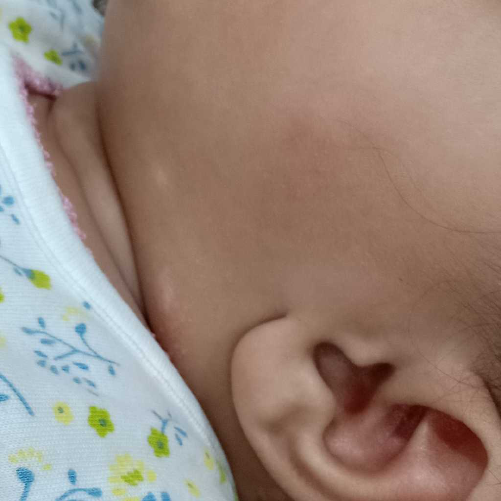 My 5months Old Baby Girl Has Got White Spots In Her Body In 5 Different