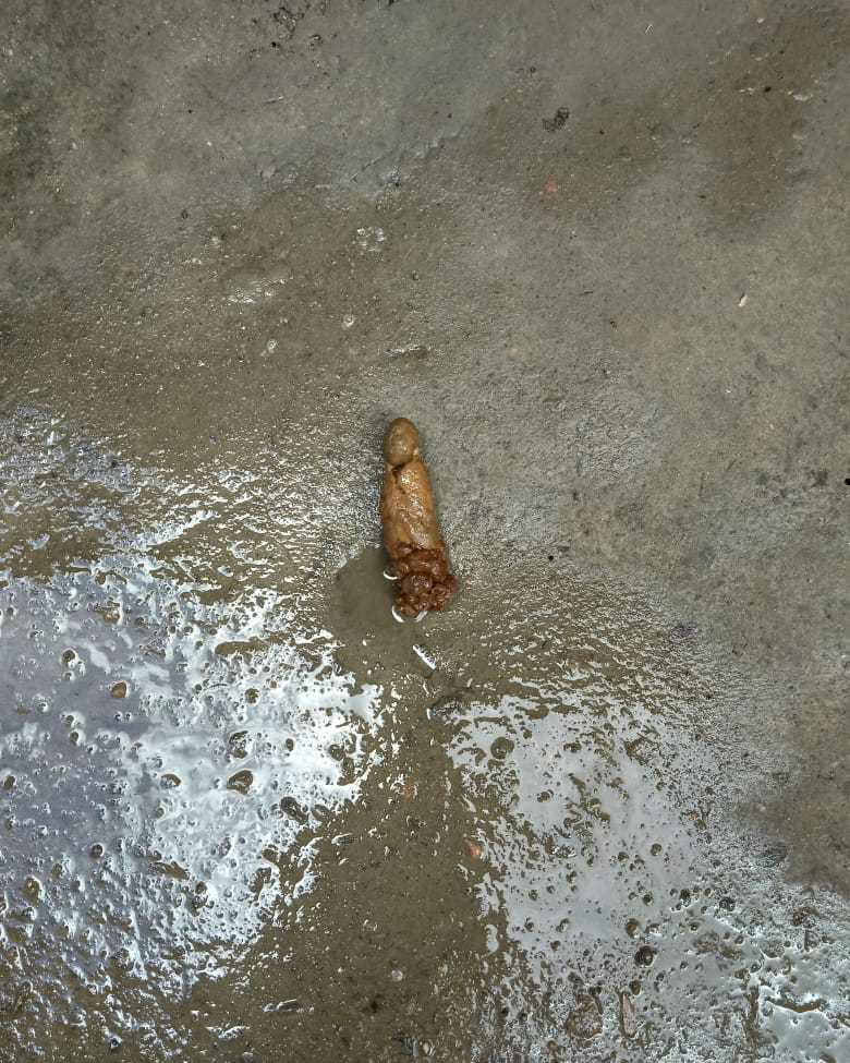 AskTheExpert my baby s having bloody stools since 7days. radicate DS