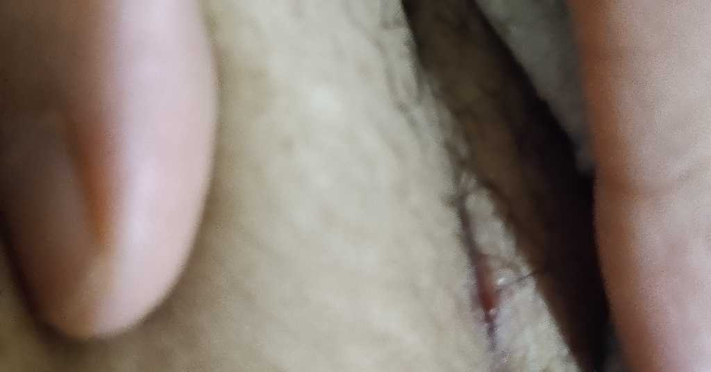 i had a c section 6 weeks back and it has come to my notice that my ...