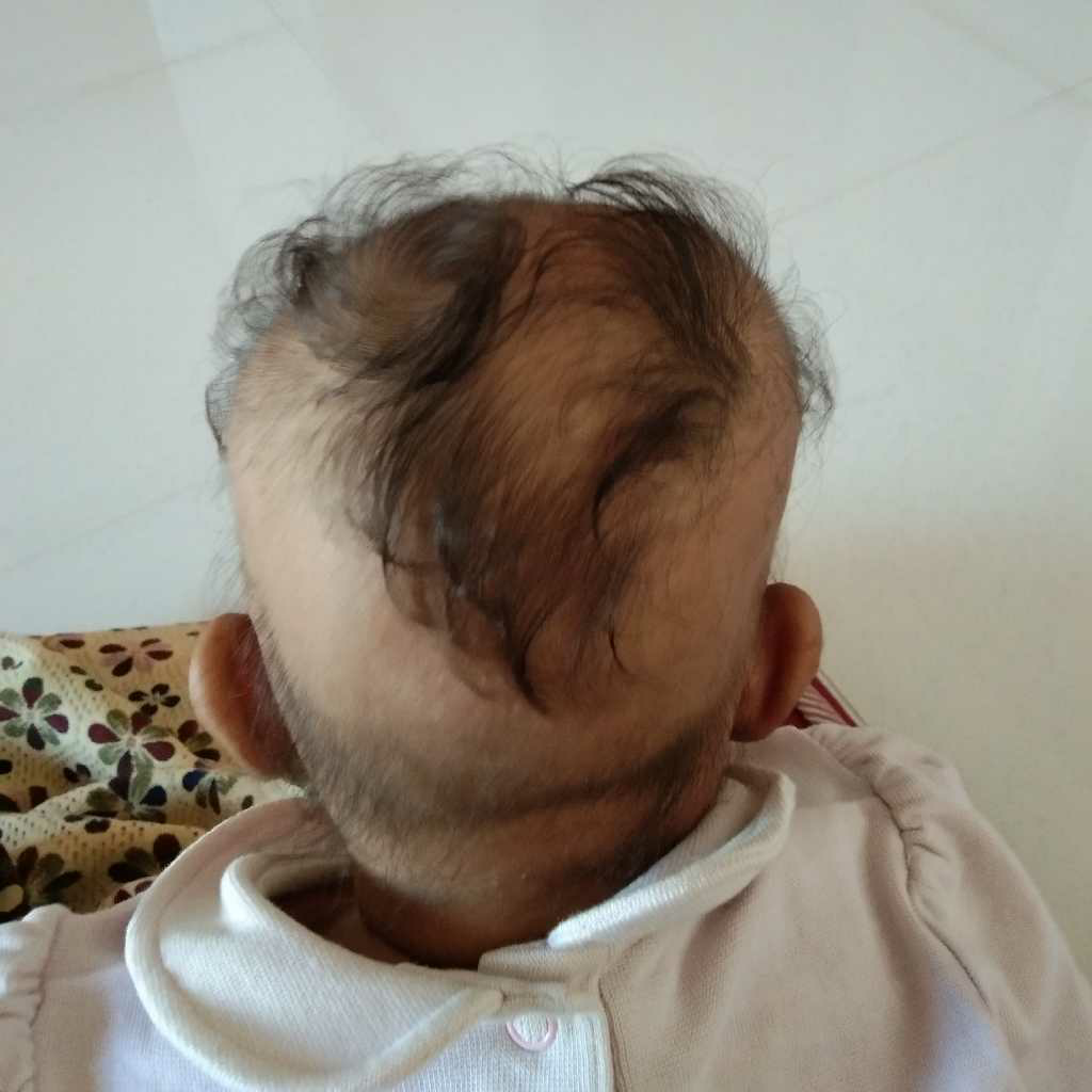 4 month old flat head