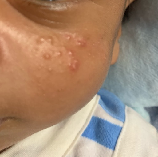 green gram powder for baby skin