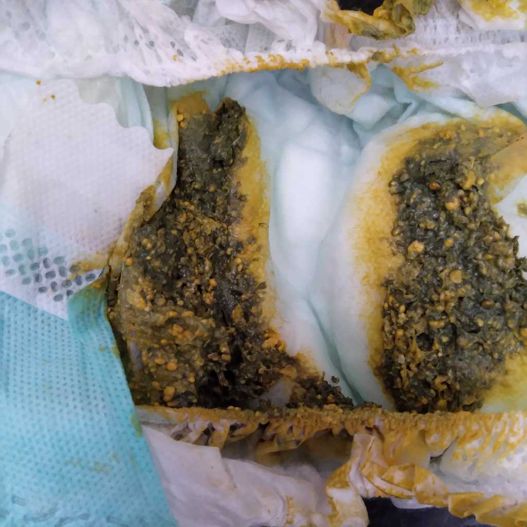 Hello everyone when my baby was born from birth to one and half month