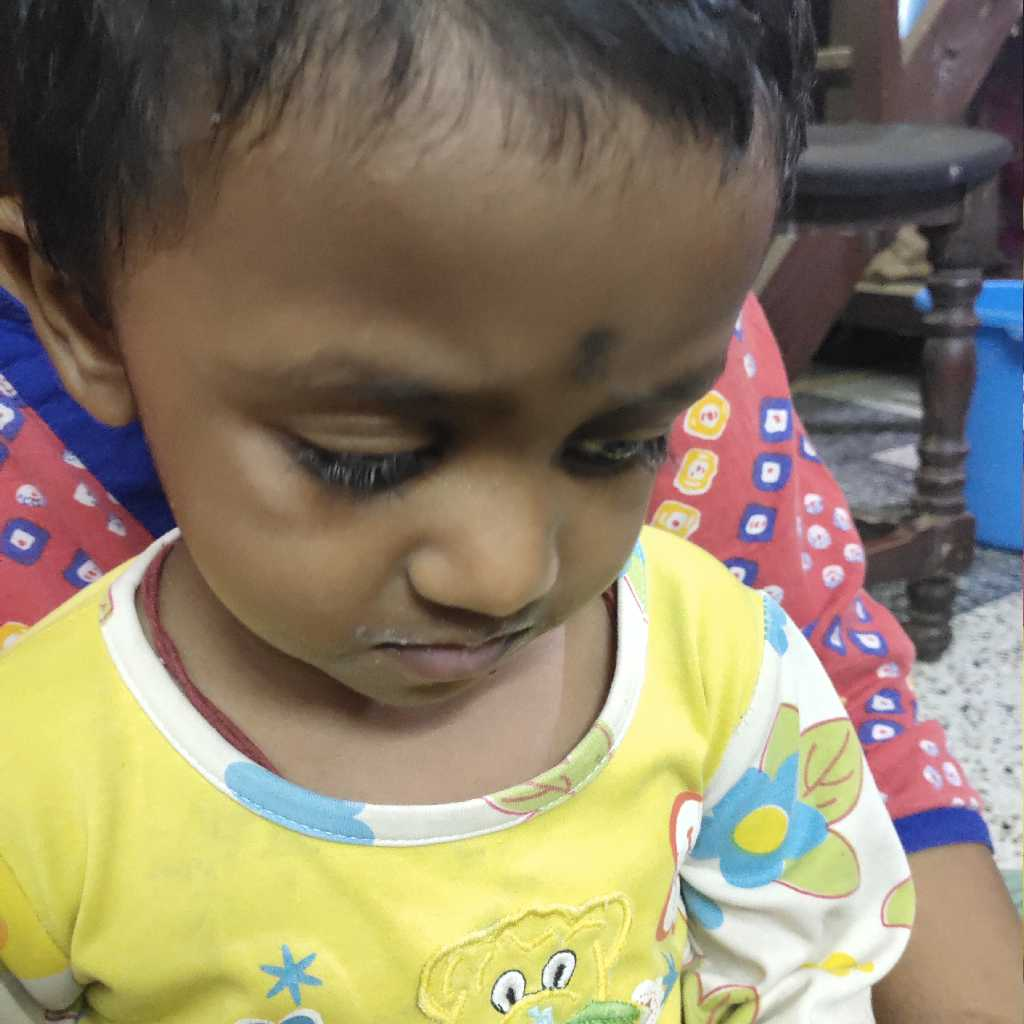 My baby got heavy rashes and the doctor gave me a rash cream . Now it