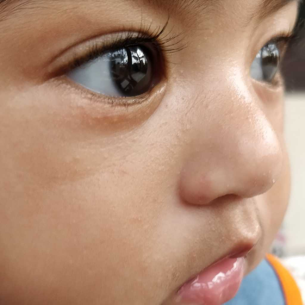 siloderm cream for baby