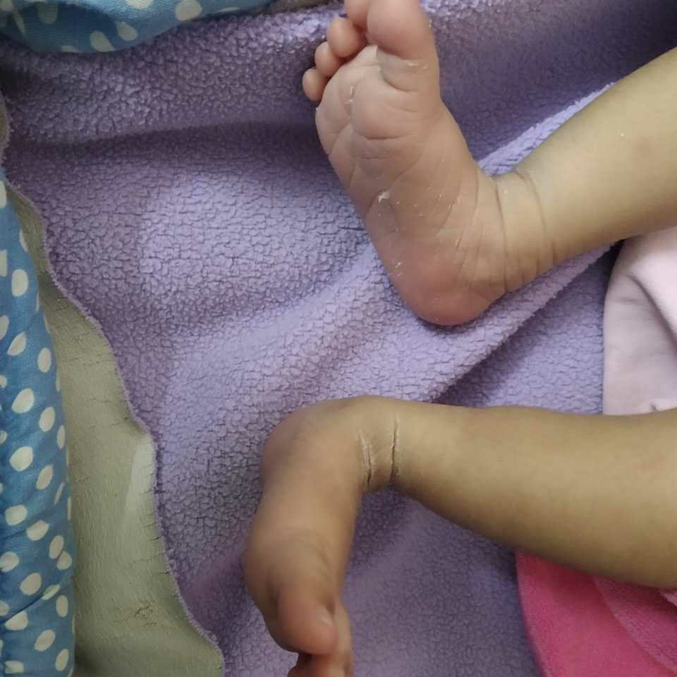 new born baby 's legs seems litle bit bend, is it stait