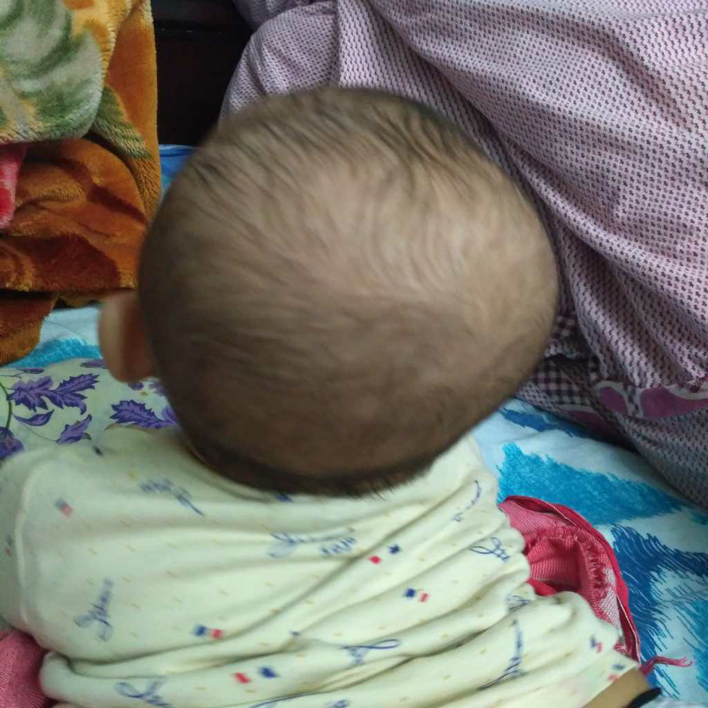 My baby has a long elongated head. what kind of pillow should be used