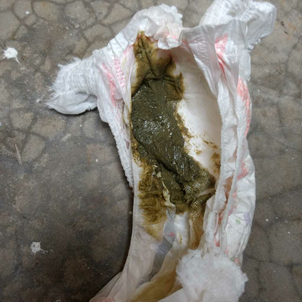 sir , my son is 7 month old and he poop( dark green colour )cotinously