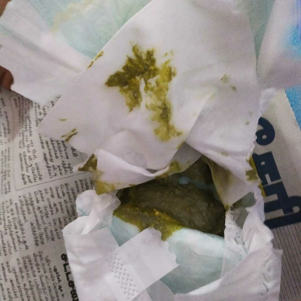 hello All, my baby is 7 weeks old now. from yesterday we started giving