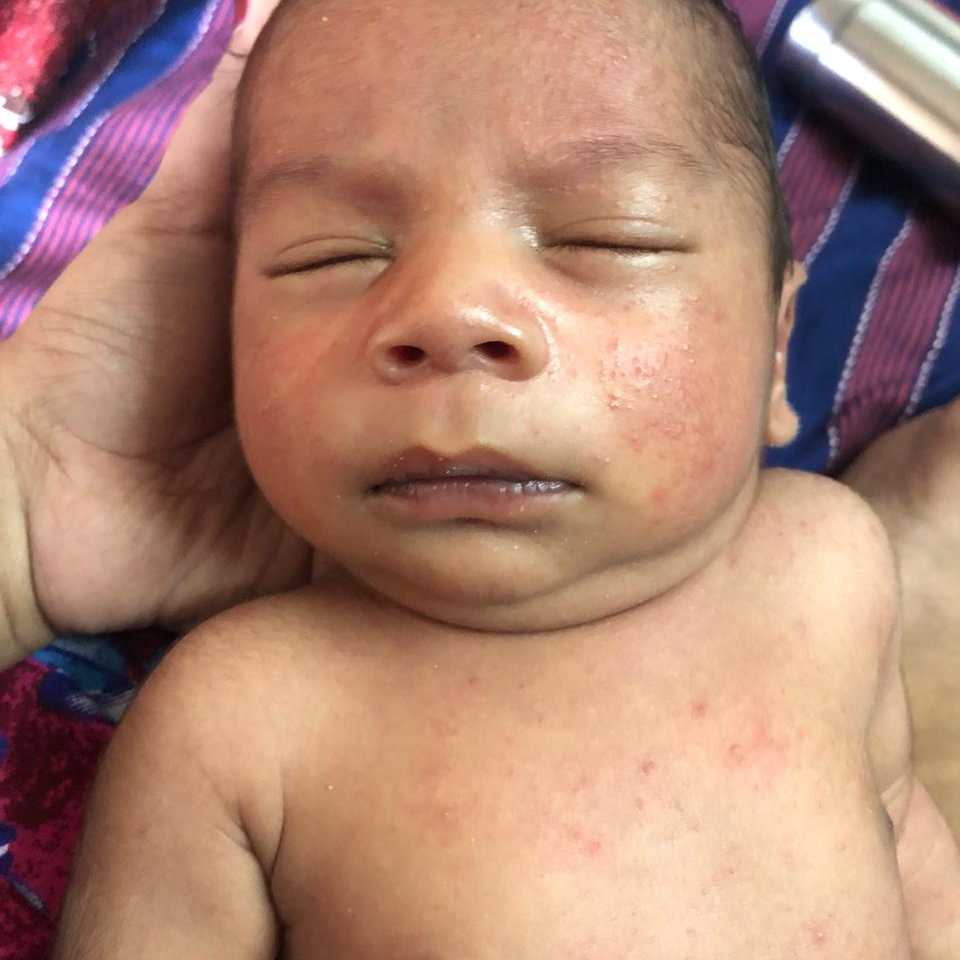 himalaya baby rashes powder