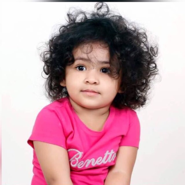 Dear Madam One Of My Twin Girl Has A White Birth Mark On Her